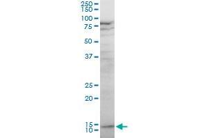 KLRF1 polyclonal antibody (A01), Lot # 051214JC01. (KLRF1 Antikörper  (AA 69-166))