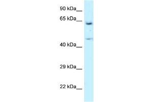 WB Suggested Anti-NARS Antibody Titration: 1. (NARS Antikörper  (N-Term))