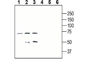 Western blot analysis of mouse EL4 T-cell lymphoma cell line lysate (lanes 1 and 4), mouse  B-cell lymphoma cell line lysate (lanes 2 and 5) and mouse  microglia cell line lysate (lanes 3 and 6):1-3.
