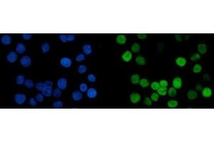 IF analysis of MCM6 using anti-MCM6 antibody (ABIN7600038). (MCM6 Antikörper  (AA 14-821))