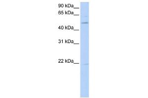 WB Suggested Anti-RORB Antibody Titration:  0. (RORB Antikörper  (C-Term))