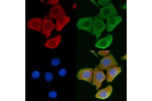ABIN6261103 and ABIN6276877 staining Hela cells by IF/ICC. (Cathepsin K Antikörper  (N-Term))