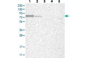 Western blot analysis of Lane 1: RT-4, Lane 2: U-251 MG, Lane 3: Human Plasma, Lane 4: Liver, Lane 5: Tonsil with LARP7 polyclonal antibody  at 1:250-1:500 dilution. (LARP7 Antikörper)