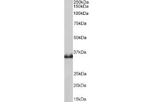 Western Blotting (WB) image for anti-Lactate Dehydrogenase B (LDHB) antibody (ABIN5870352) (LDHB Antikörper)