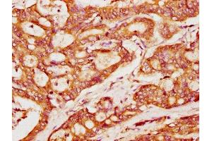Immunohistochemistry (IHC) image for anti-Protein Kinase C and Casein Kinase Substrate in Neurons 2 (PACSIN2) (AA 240-410) antibody (ABIN7165686)