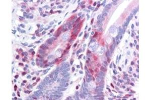 Immunohistochemistry (IHC) image for anti-Programmed Cell Death 4 (PDCD4) (pSer457) antibody (ABIN400797) (PDCD4 Antikörper  (pSer457))