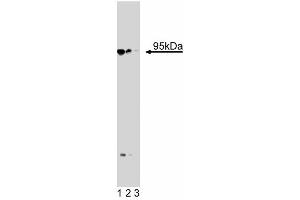 Western blot analysis of Neurotensin Receptor 3 on a PFSK-1 cell lysate (Human neuroectodermal tumor line, ATCC CRL-2060). (Sortilin 1 Antikörper  (AA 300-422))