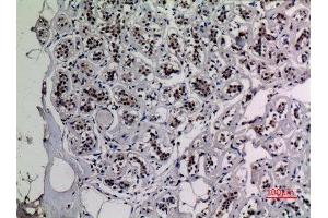Immunohistochemistry (IHC) analysis of paraffin-embedded Human Breast, antibody was diluted at 1:100. (NF-kB p65 Antikörper  (acLys218))