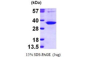 SDS-PAGE (SDS) image for Uridine Phosphorylase 1 (UPP1) (AA 1-310) protein (His tag) (ABIN667819) (UPP1 Protein (AA 1-310) (His tag))