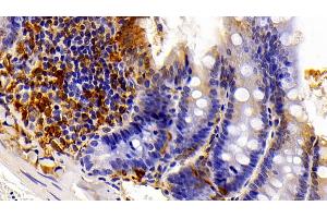 Detection of GAL3 in Rat Colon Tissue using Polyclonal Antibody to Galectin 3 (GAL3) (Galectin 3 Antikörper  (AA 1-262))