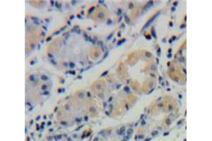 Used in DAB staining on fromalin fixed paraffin-embedded Stomach tissue (UBD Antikörper  (AA 1-165))