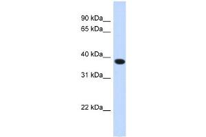 ACBD4 antibody used at 1 ug/ml to detect target protein. (ACBD4 Antikörper  (N-Term))