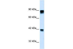 WB Suggested Anti-RB1 Antibody Titration: 0. (Retinoblastoma 1 Antikörper  (C-Term))