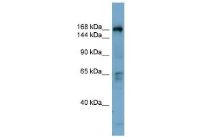 WB Suggested Anti-DOCK2 Antibody Titration: 0. (DOCK2 Antikörper  (Middle Region))