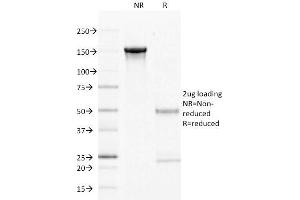 SDS-PAGE Analysis Purified CD22 Mouse Monoclonal Antibody (LPFS2/1611).