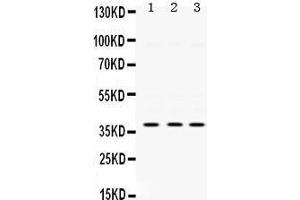 Western Blotting (WB) image for anti-Protein Kinase, AMP-Activated, beta 1 Non-Catalytic Subunit (PRKAB1) (AA 32-68), (N-Term) antibody (ABIN3043359) (PRKAB1 Antikörper  (N-Term))