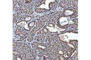 IHC analysis of HNRNPL using anti-HNRNPL antibody (ABIN4886624). (HNRNPL Antikörper  (C-Term))
