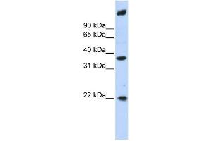 SSBP3 antibody used at 1 ug/ml to detect target protein. (SSBP3 Antikörper  (Middle Region))