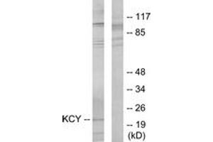Western blot analysis of extracts from HeLa cells, using KCY Antibody. (KCY (AA 1-50) Antikörper)