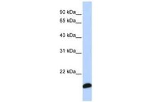 Image no. 1 for anti-Peroxiredoxin 5 (PRDX5) (C-Term) antibody (ABIN6741267) (Peroxiredoxin 5 Antikörper  (C-Term))