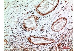 Immunohistochemistry (IHC) analysis of paraffin-embedded Human Brain, antibody was diluted at 1:100. (IL1R1 Antikörper  (N-Term))