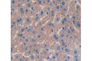 IHC-P analysis of Kidney tissue, with DAB staining. (Complement Factor I Antikörper  (AA 358-603))