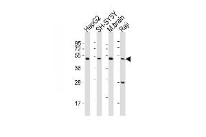 All lanes : Anti-CTBP1 Antibody (C-term) at 1:2000 dilution Lane 1: HepG2 whole cell lysates Lane 2: SH-SY5Y whole cell lysates Lane 3: mouse brain lysates Lane 4: Raji whole cell lysates Lysates/proteins at 20 μg per lane. (CTBP1 Antikörper  (C-Term))