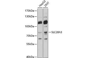 Western blot analysis of extracts of various cell lines, using SLC28 antibody (ABIN6133437, ABIN6147944, ABIN6147945 and ABIN6214531) at 1:1000 dilution. (SLC28A3 Antikörper  (AA 612-691))