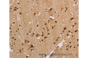 Immunohistochemistry of Human brain  using KCNG4 Polyclonal Antibody at dilution of 1:40