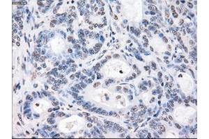 Image no. 3 for anti-P450 (Cytochrome) Oxidoreductase (POR) antibody (ABIN1497743) (POR Antikörper)