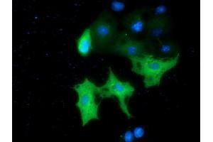Anti-MTMR14 mouse monoclonal antibody (ABIN2453334) immunofluorescent staining of COS7 cells transiently transfected by pCMV6-ENTRY MTMR14 (RC207732). (MTMR14 Antikörper)