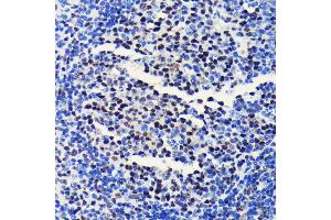 Immunohistochemistry of paraffin-embedded mouse spleen using BRG1/SM antibody (ABIN7270655) at dilution of 1:100 (40x lens). (SMARCA4 Antikörper)