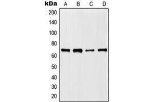 Western blot analysis of HKR1 expression in HepG2 (A), NIH3T3 (B), mouse liver (C), rat liver (D) whole cell lysates. (HKR1 Antikörper  (Center))