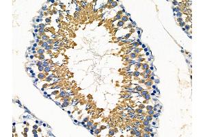 ABIN6260022 and ABIN6276440 at 1/100 staining Rat testis tissue by IHC-P. (ARF6 Antikörper  (Internal Region))