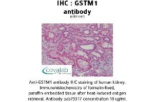 Image no. 1 for anti-Glutathione S-Transferase mu 1 (GSTM1) (AA 1-159) antibody (ABIN1735304) (GSTM1 Antikörper  (AA 1-159))