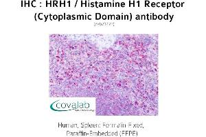 Image no. 1 for anti-Histamine Receptor H1 (HRH1) (3rd Cytoplasmic Domain) antibody (ABIN1735570) (HRH1 Antikörper  (3rd Cytoplasmic Domain))