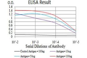 Fig. (beta 2 Adrenergic Receptor Antikörper  (AA 302-413))