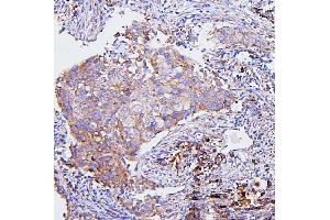IHC analysis of CETP using anti-CETP antibody (ABIN7602439). (CETP Antikörper  (AA 77-353))