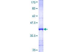 Myosin VIIA (MYO7A) (AA 2118-2213) protein (GST tag)