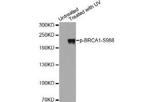 Western blot analysis of extracts from Hela cells using Phospho-BRCA1-S988 antibody. (BRCA1 Antikörper  (pSer988))