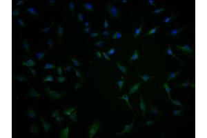 Immunofluorescence staining of U251 cells with ABIN7171646 at 1:100, counter-stained with DAPI. (TBC1D3G Antikörper  (AA 312-549))