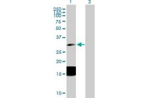 Western Blot analysis of ESM1 expression in transfected 293T cell line by ESM1 MaxPab polyclonal antibody. (ESM1 Antikörper  (AA 1-184))
