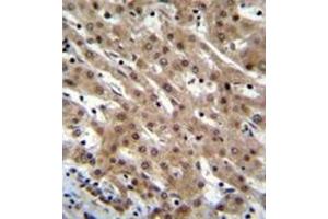 Formalin fixed and paraffin embedded human liver tissue reacted with Pinin / PNN  Antibody  followed by peroxidase conjugation of the secondary antibody and DAB staining.