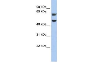 WB Suggested Anti-ZP1 Antibody Titration: 0. (ZP1 Antikörper  (Middle Region))