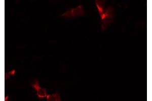 Immunofluorescence (fixed cells) (IF/ICC) image for anti-Armadillo Repeat Containing, X-Linked 3 (ARMCX3) (N-Term) antibody (ABIN6260044)
