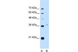 PEX3 Antikörper  (N-Term)