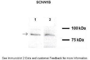 Western Blotting (WB) image for anti-Sodium Channel, Nonvoltage-Gated 1, beta (SCNN1B) (C-Term) antibody (ABIN2776090)