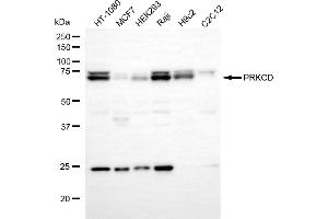 Western blotting analysis using PRKCD antibody (ABIN7799994).