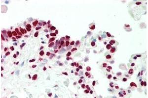 Immunohistochemistry (IHC) image for anti-Nuclear Receptor Subfamily 2, Group F, Member 6 (NR2F6) (N-Term) antibody (ABIN6754924)