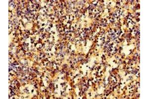 Immunohistochemistry of paraffin-embedded human spleen tissue using ABIN7167270 at dilution of 1:100 (RAB27A Antikörper  (AA 2-221))